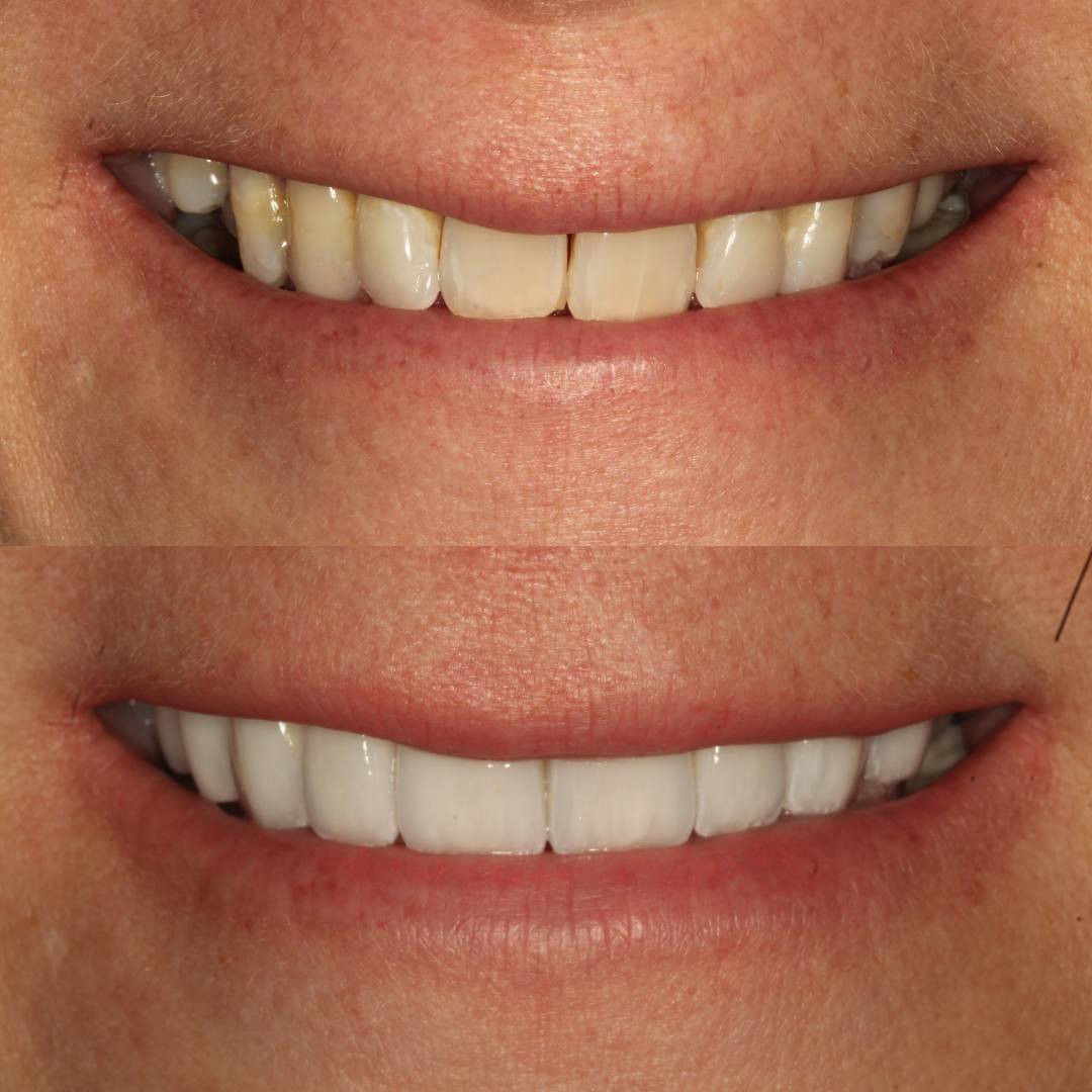 Pain Free Dentist in Edinburgh | Cherrybank Dental Spa Edinburgh Pain Free Dentist in Edinburgh | Cherrybank Dental Spa Edinburgh