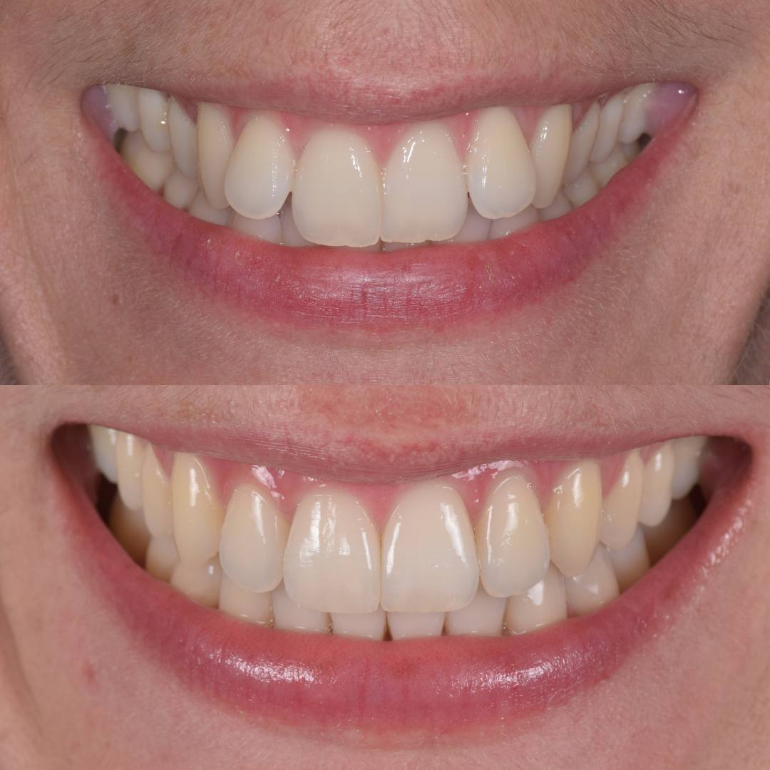 Pain Free Dentist in Edinburgh | Cherrybank Dental Spa Edinburgh Pain Free Dentist in Edinburgh | Cherrybank Dental Spa Edinburgh