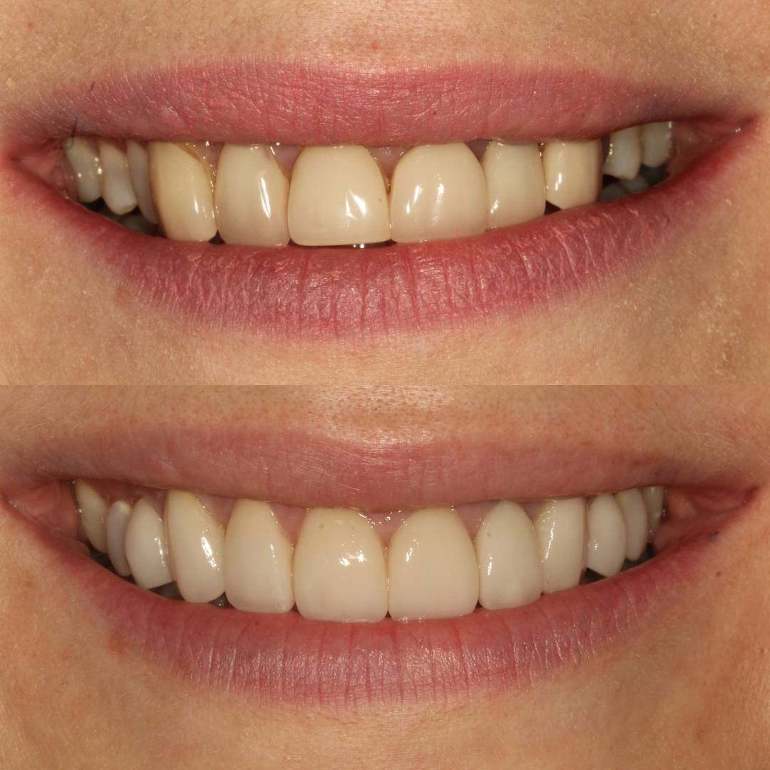 Pain Free Dentist in Edinburgh | Cherrybank Dental Spa Edinburgh Pain Free Dentist in Edinburgh | Cherrybank Dental Spa Edinburgh