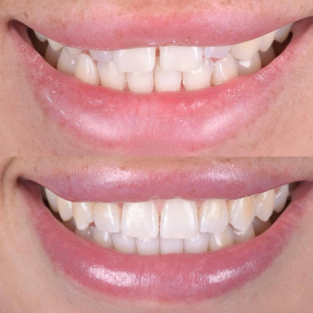 Pain Free Dentist in Edinburgh | Cherrybank Dental Spa Edinburgh Pain Free Dentist in Edinburgh | Cherrybank Dental Spa Edinburgh