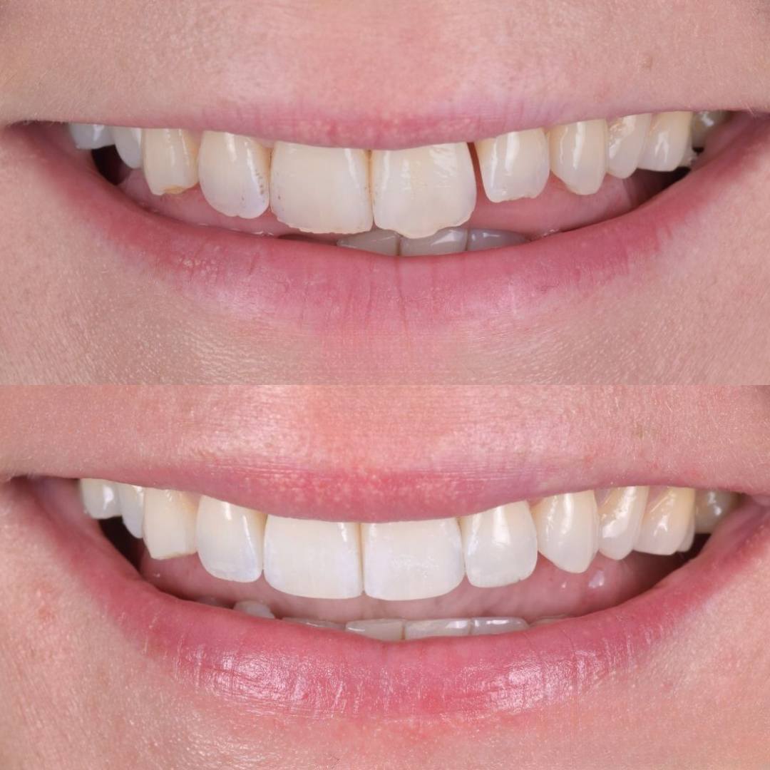 Pain Free Dentist in Edinburgh | Cherrybank Dental Spa Edinburgh Pain Free Dentist in Edinburgh | Cherrybank Dental Spa Edinburgh