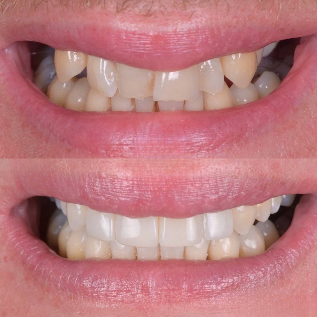 Pain Free Dentist in Edinburgh | Cherrybank Dental Spa Edinburgh Pain Free Dentist in Edinburgh | Cherrybank Dental Spa Edinburgh