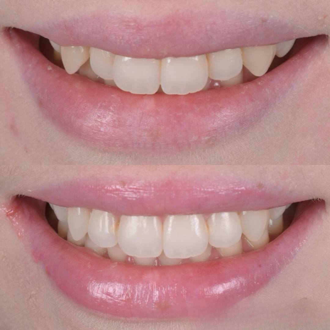 Pain Free Dentist in Edinburgh | Cherrybank Dental Spa Edinburgh Pain Free Dentist in Edinburgh | Cherrybank Dental Spa Edinburgh