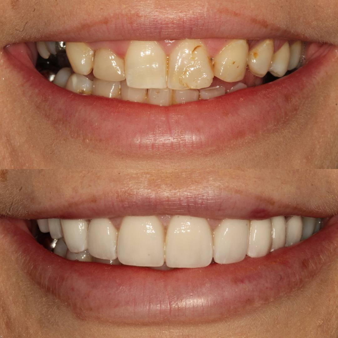 Pain Free Dentist in Edinburgh | Cherrybank Dental Spa Edinburgh Pain Free Dentist in Edinburgh | Cherrybank Dental Spa Edinburgh