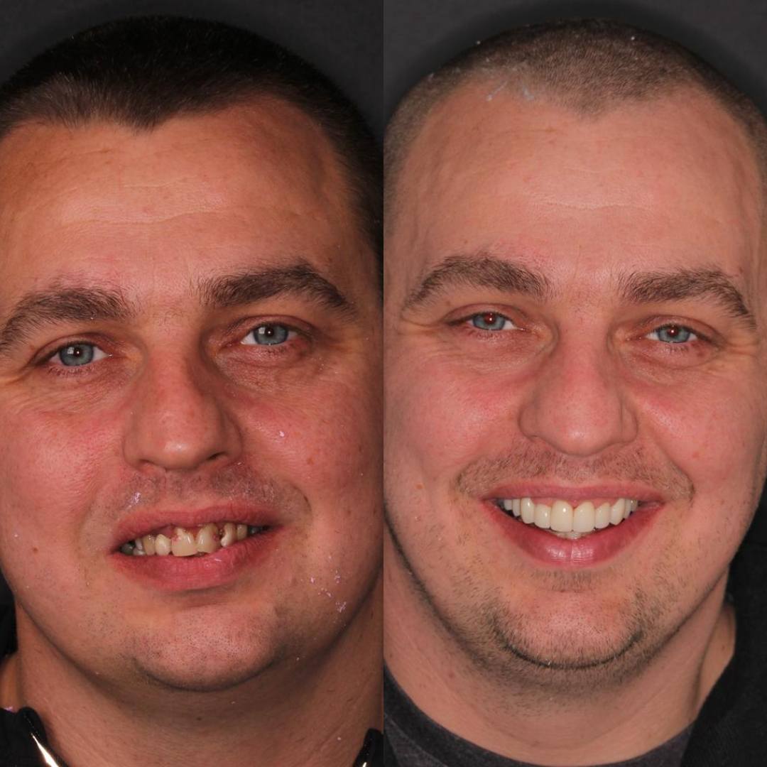 Pain Free Dentist in Edinburgh | Cherrybank Dental Spa Edinburgh Pain Free Dentist in Edinburgh | Cherrybank Dental Spa Edinburgh