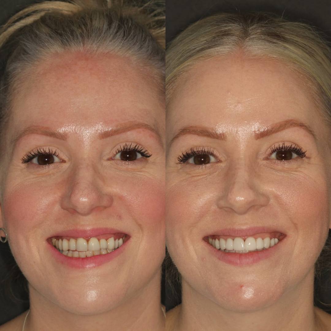 Pain Free Dentist in Edinburgh | Cherrybank Dental Spa Edinburgh Pain Free Dentist in Edinburgh | Cherrybank Dental Spa Edinburgh