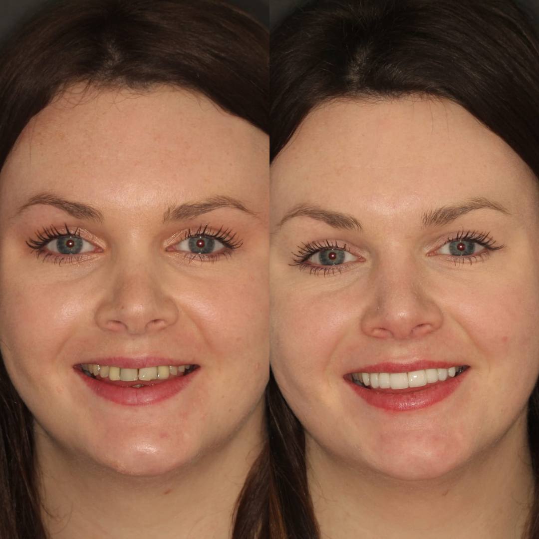 Pain Free Dentist in Edinburgh | Cherrybank Dental Spa Edinburgh Pain Free Dentist in Edinburgh | Cherrybank Dental Spa Edinburgh