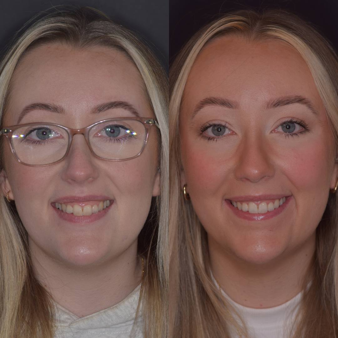 Pain Free Dentist in Edinburgh | Cherrybank Dental Spa Edinburgh Pain Free Dentist in Edinburgh | Cherrybank Dental Spa Edinburgh