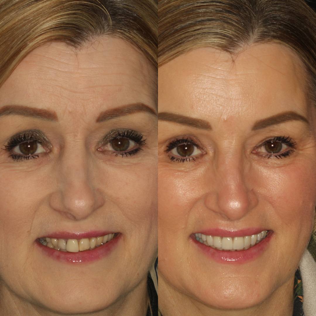 Pain Free Dentist in Edinburgh | Cherrybank Dental Spa Edinburgh Pain Free Dentist in Edinburgh | Cherrybank Dental Spa Edinburgh