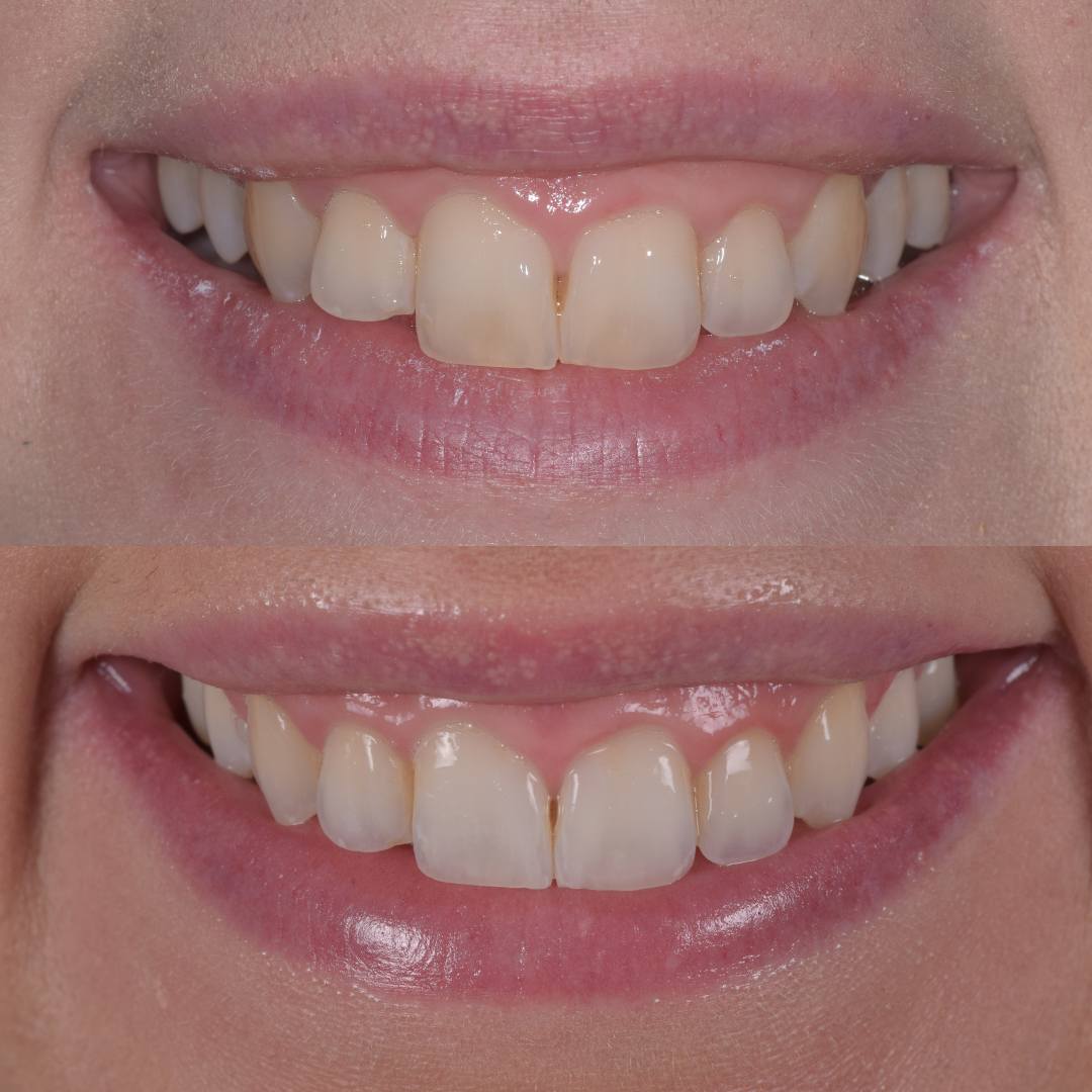 Pain Free Dentist in Edinburgh | Cherrybank Dental Spa Edinburgh Pain Free Dentist in Edinburgh | Cherrybank Dental Spa Edinburgh