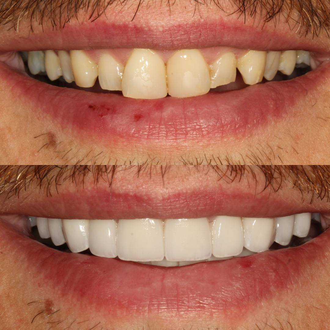 Pain Free Dentist in Edinburgh | Cherrybank Dental Spa Edinburgh Pain Free Dentist in Edinburgh | Cherrybank Dental Spa Edinburgh