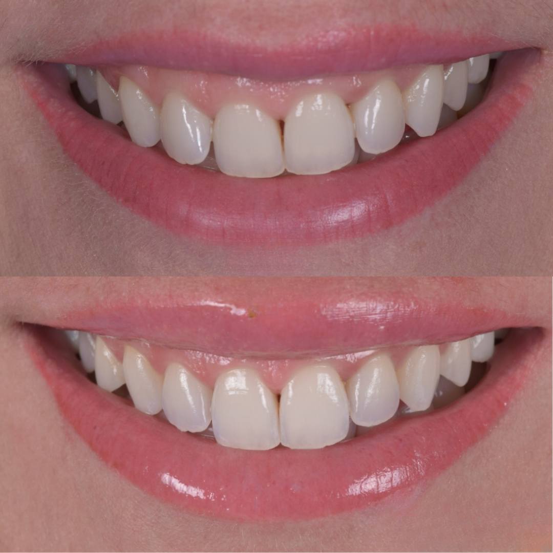 Pain Free Dentist in Edinburgh | Cherrybank Dental Spa Edinburgh Pain Free Dentist in Edinburgh | Cherrybank Dental Spa Edinburgh
